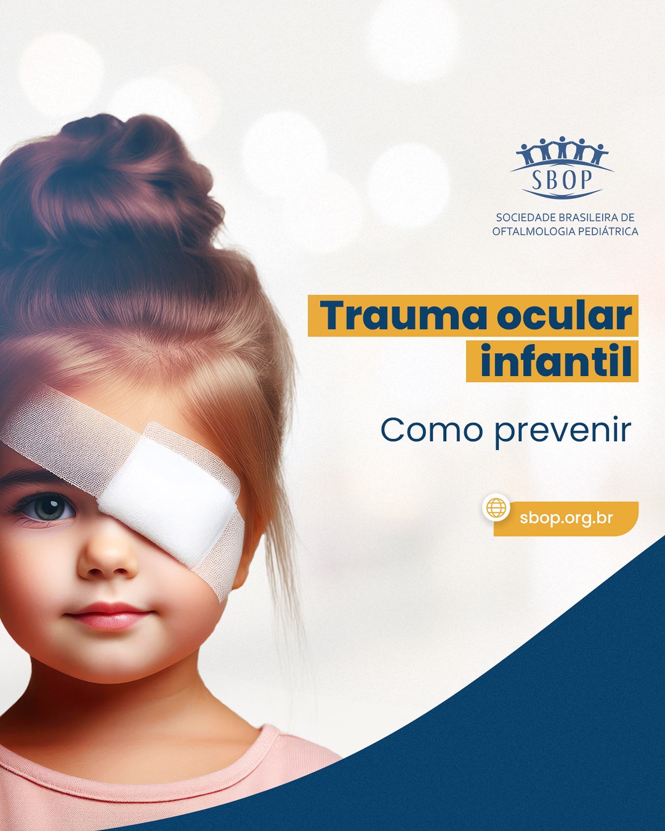 Trauma ocular infantil, como prevenir